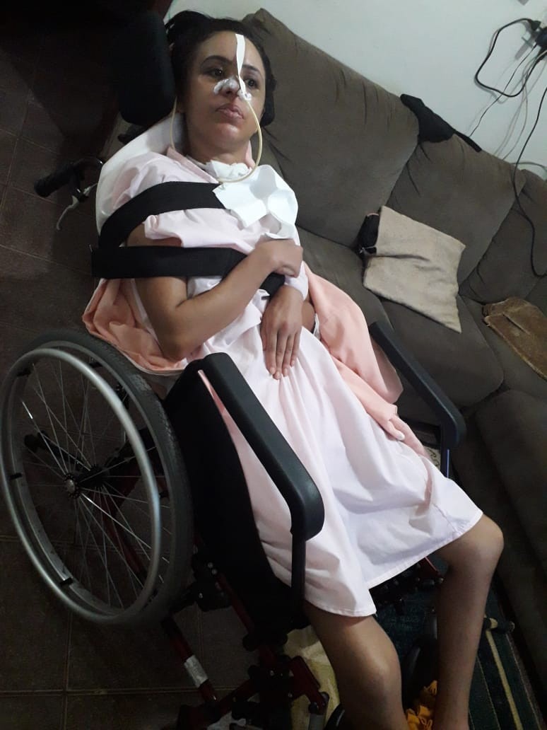 Michelle de Souza Brito seis meses após a agressão - Foto: Arquivo pessoal