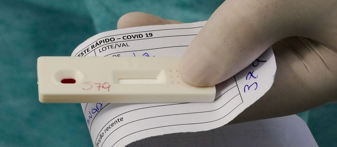 Coronavírus em Maringá: Saiba os dados do boletim desta sexta-feira (16)