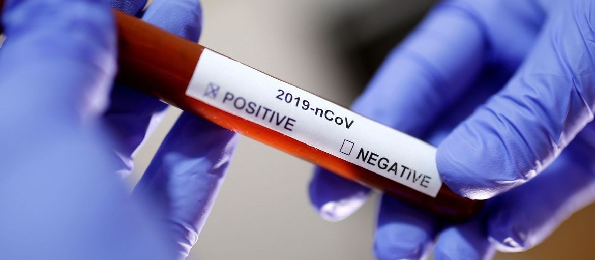 Mais quatro pessoas testam positivo para coronavírus em Maringá