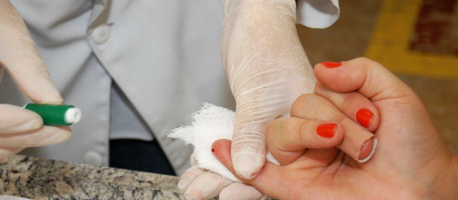 Em surto, Curitiba registra 150 casos de Hepatite A em 2024