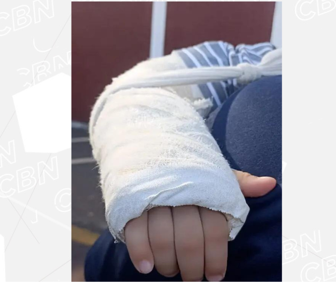 Criança volta de CMEI com braço quebrado e pais registram queixa