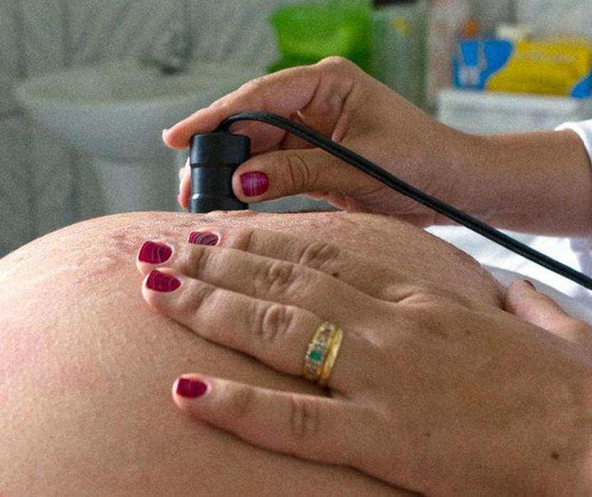 Evolução da medicina permite uma gravidez mais tardia e segura