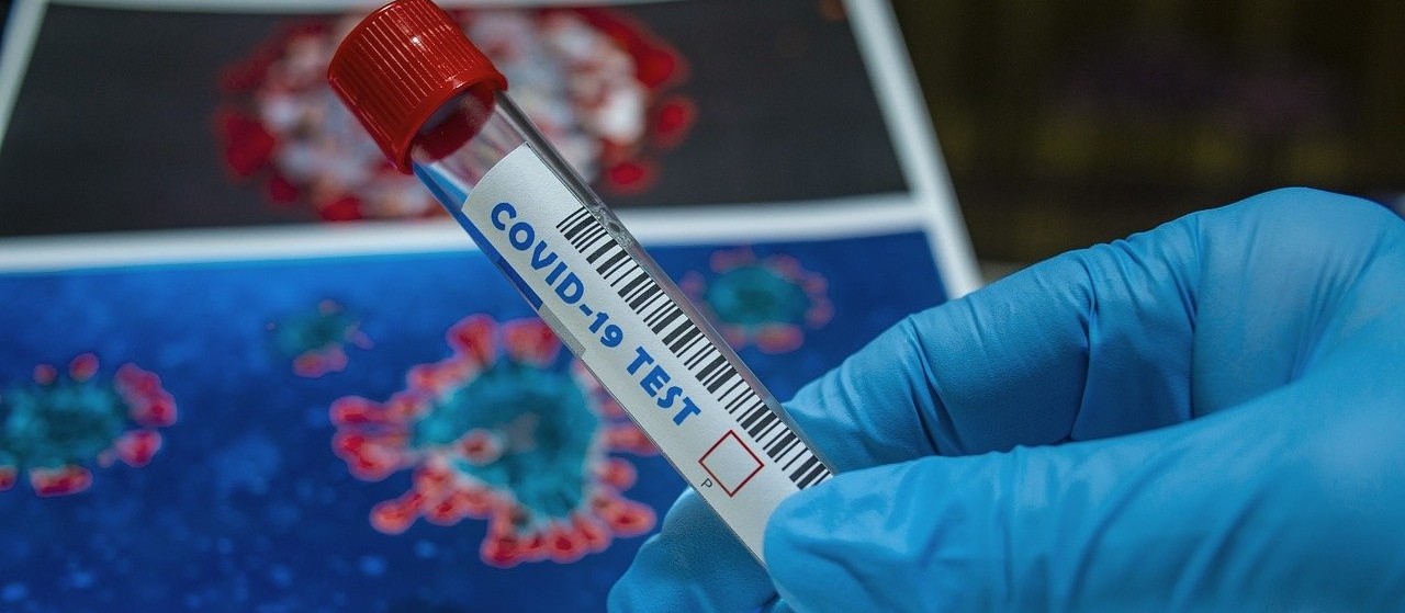 Coronavírus: veja os dados do boletim desta terça-feira (26), em Maringá