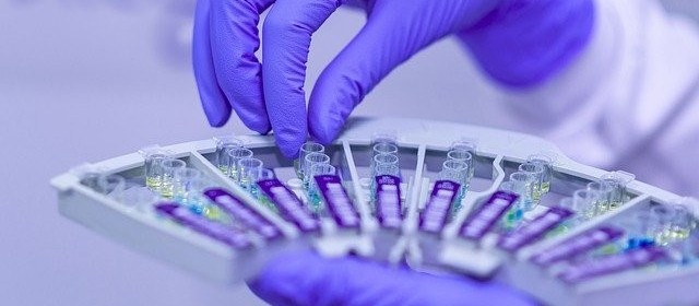 Covid-19: Veja os dados do boletim desta sexta-feira (15), em Maringá