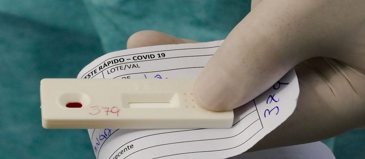 Farmácia de Maringá oferece exame rápido antígeno de Covid-19