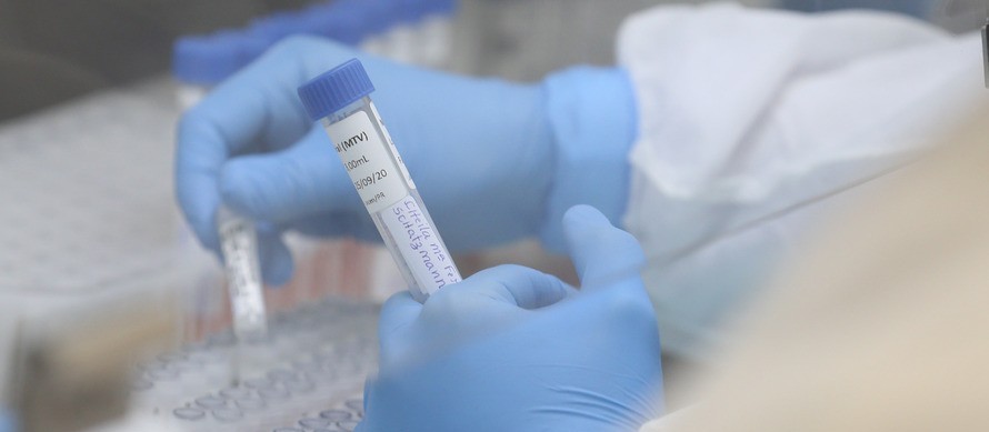 Secretaria de Saúde de Maringá comprou seis mil testes entre PCR e antígeno