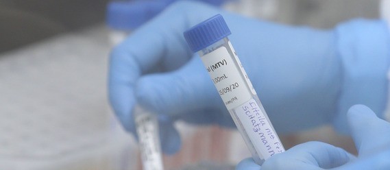 Testes são indispensáveis enquanto não se tem uma vacina contra o coronavírus