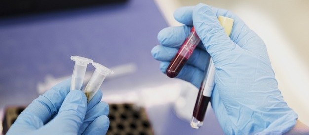 Confira os dados da Covid-19 desta terça-feira (12), em Maringá