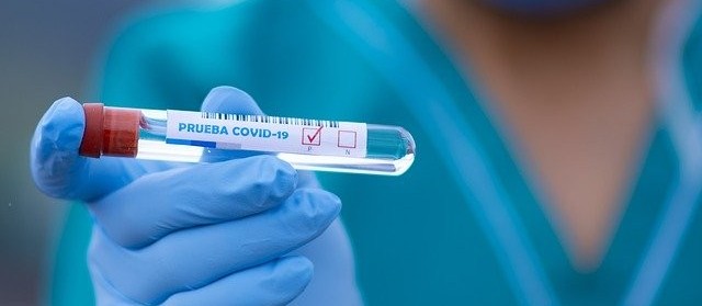 Coronavírus: Maringá registra 189 casos e nenhum óbito neste sábado