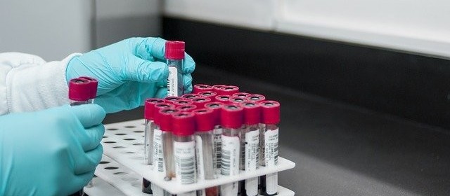 Covid-19: Maringá confirma 1.593 novos casos e 6 óbitos no boletim desta sexta-feira (28)