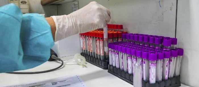Saiba os dados sobre a Covid-19 desta segunda-feira (20) em Maringá
