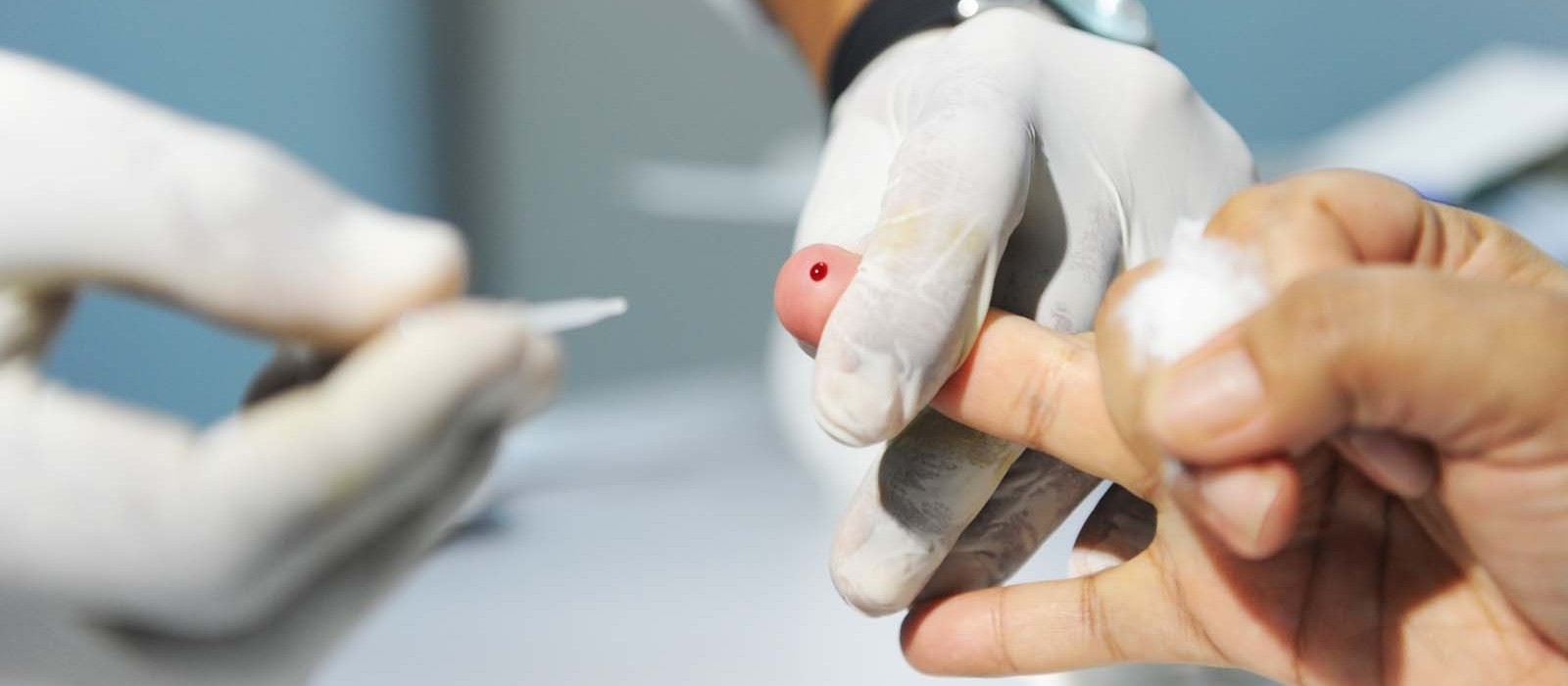 Saúde ofertará testes rápidos de HIV, sífilis e hepatites virais