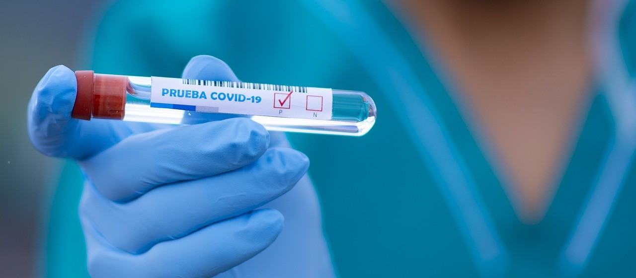 Coronavírus: saiba os dados desta sexta-feira (9) em Maringá
