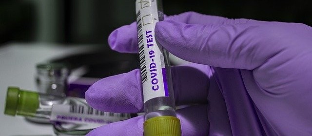 Coronavírus: veja os dados desta terça-feira (2), em Maringá