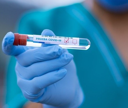 Coronavírus: Veja os dados do boletim desta terça-feira (18), em Maringá