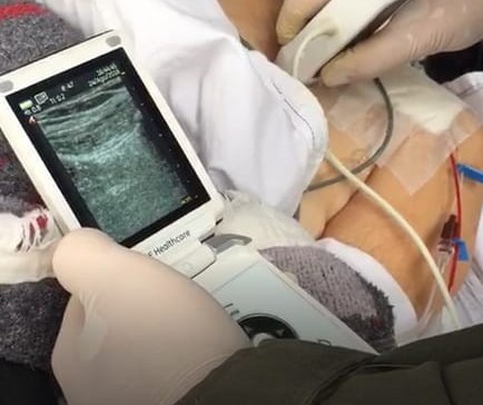 Ultrassom portátil permite avaliação médica em minutos 