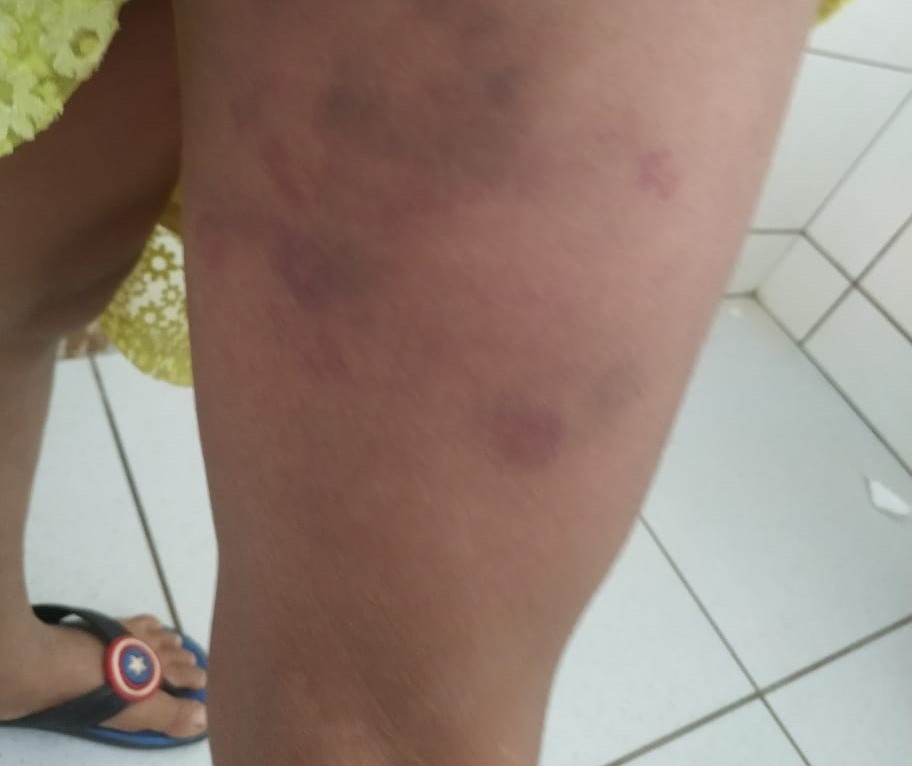 Pai é suspeito de agredir filha de 7 anos em Alto Paraná
