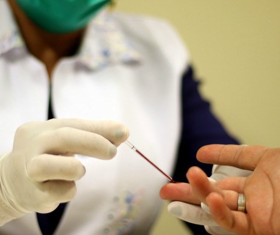 Testes de hepatite C serão feitos de graça no Parque do Ingá
