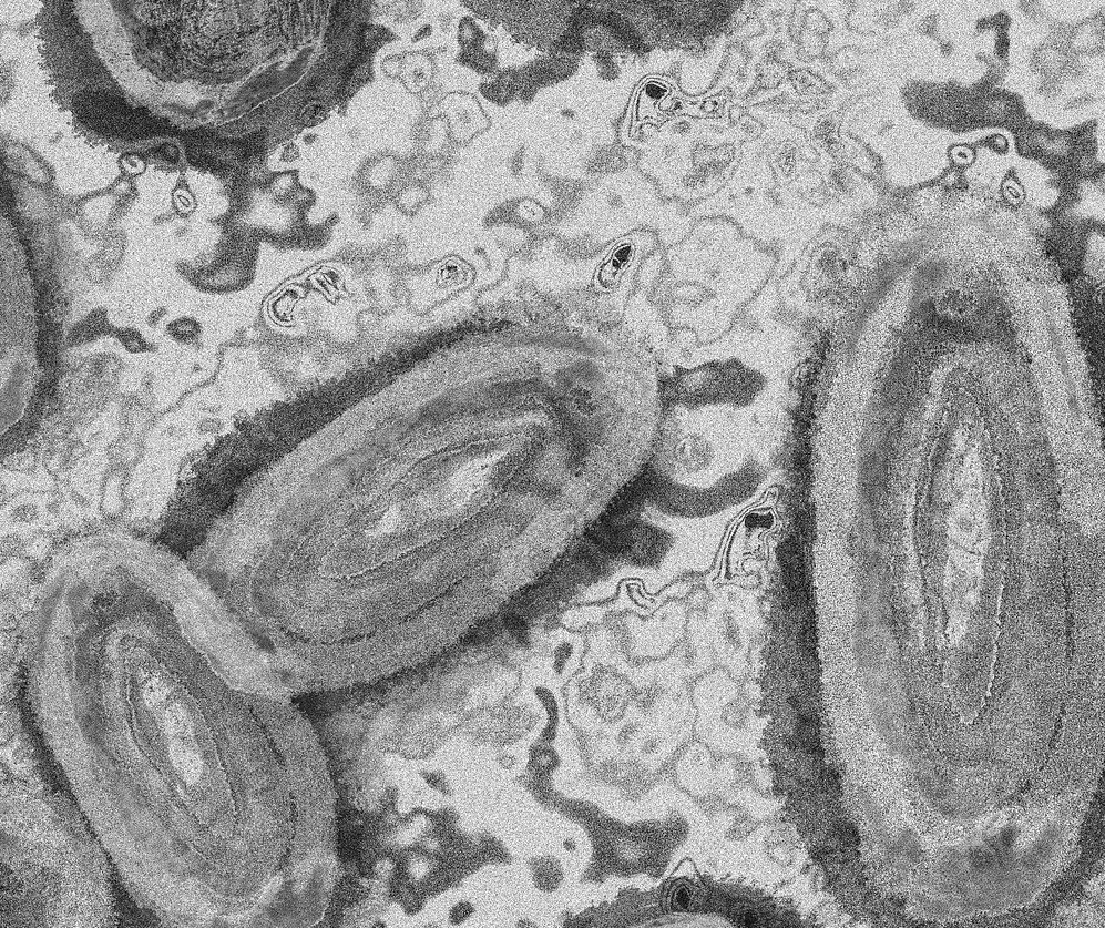 Londrina confirma mais dois casos de varíola dos macacos
