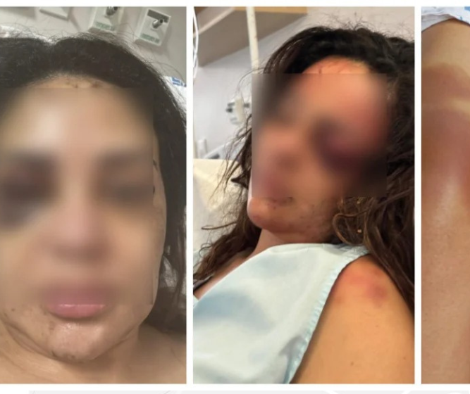 Médica espancada em apartamento relata momentos de terror