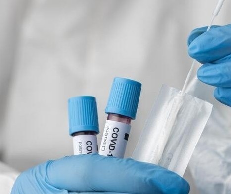 Confira os dados atualizados sobre a Covid-19 nesta terça-feira (24)