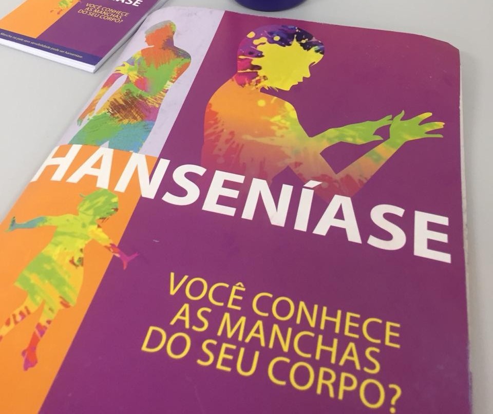 Regional de Saúde de Maringá registra 40 casos de hanseníase por ano