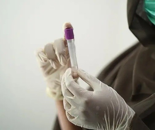Maringá registra 324 novos casos de Covid-19 e duas mortes